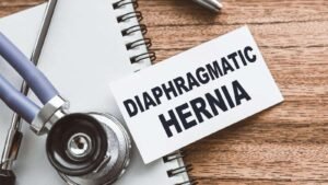 Congenital Diaphragmatic Hernia Action Day 2024 (US): Importance and Scary Facts