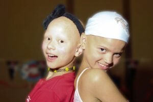Children with Alopecia Day 2024 (US): Explore its Intriguing History and Facts